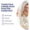 imageBoiron Acne Relief Kit for Blackheads Oily Skins Whiteheads on The Face and Body  3 Count 240 Pellets